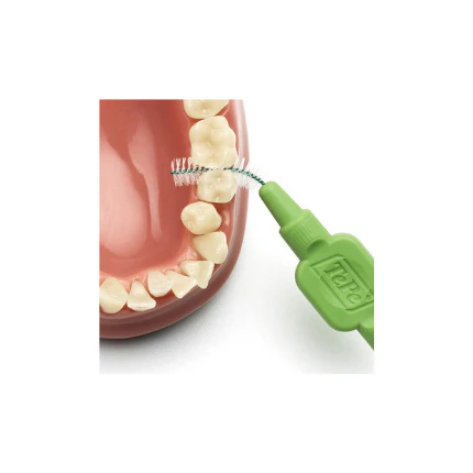 TePe Orthodontic Kit - Image 7
